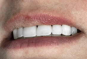 Westminster Cosmetic Dentist