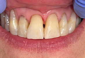 Dentist in Westminster