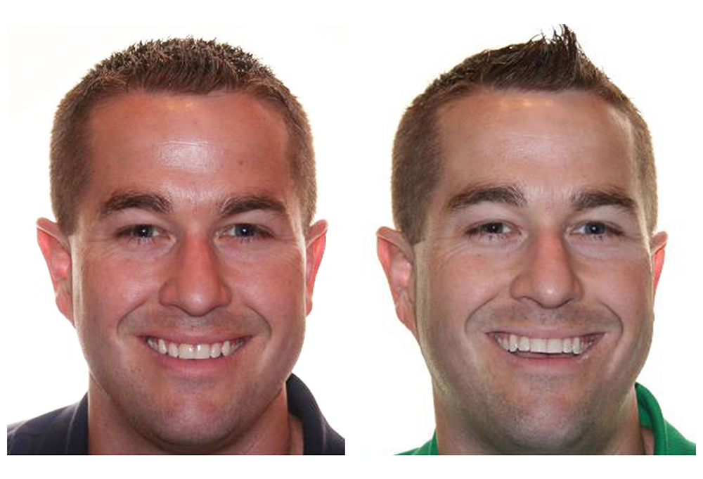 Precision Dental of Westminster