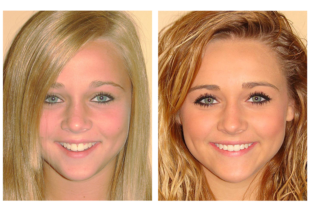 Precision Dental of Westminster